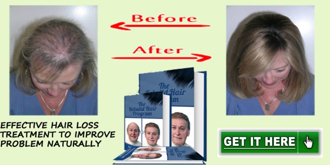 Rebuild Hair Program Hair Loss Protocol Book by Jared Gates Review | hairlossprotocol